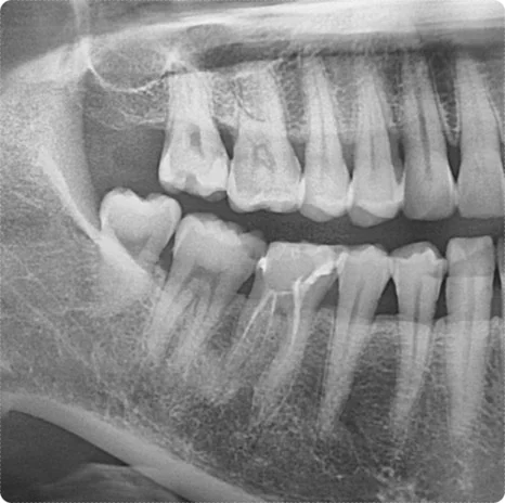 osan crown treatment doctor 4