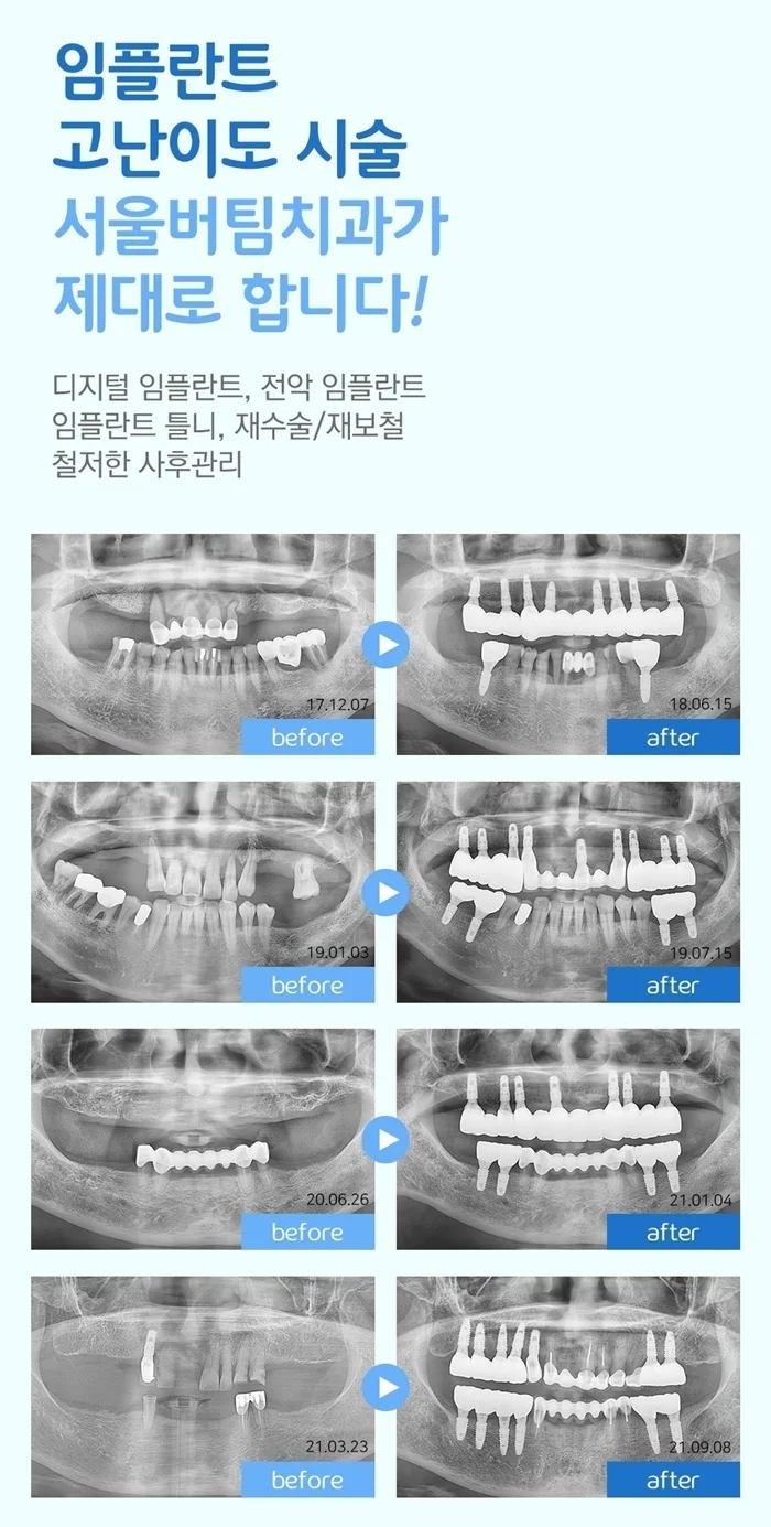 osan dental clinic recommendation 9