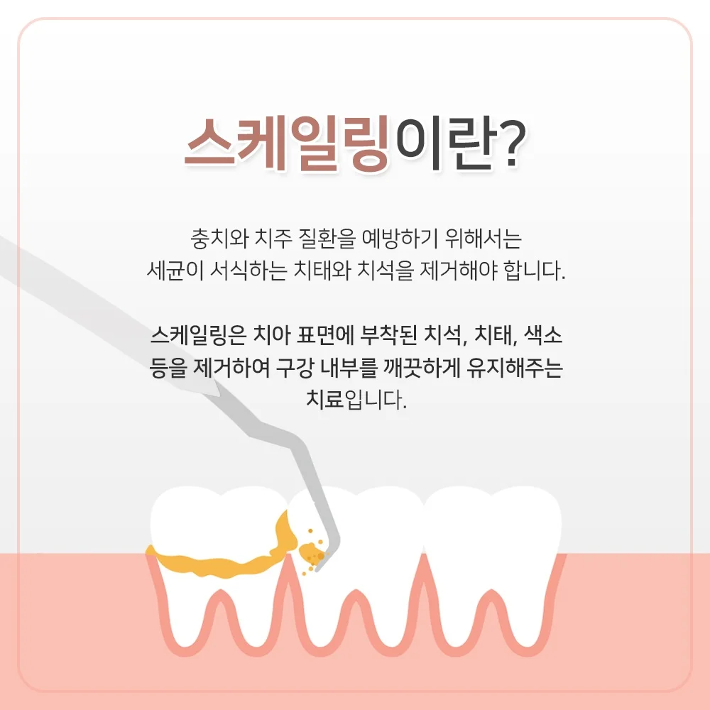 버팀균열17