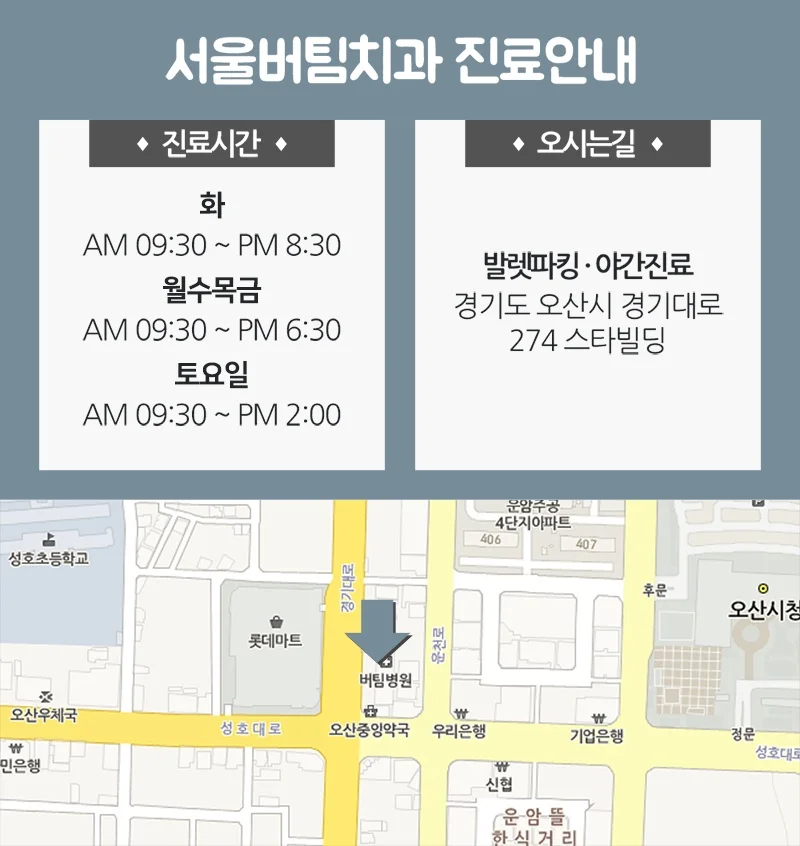버팀균열24