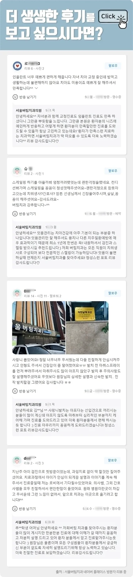 오산 임플란트 흔들림4
