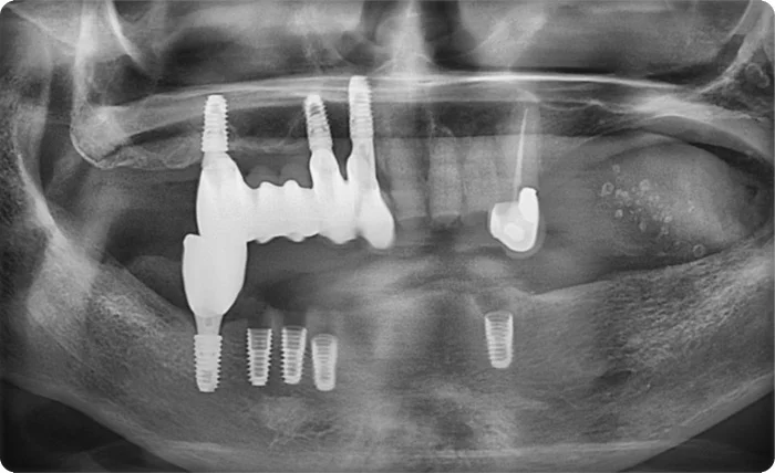 오산 치아치료 시기 2