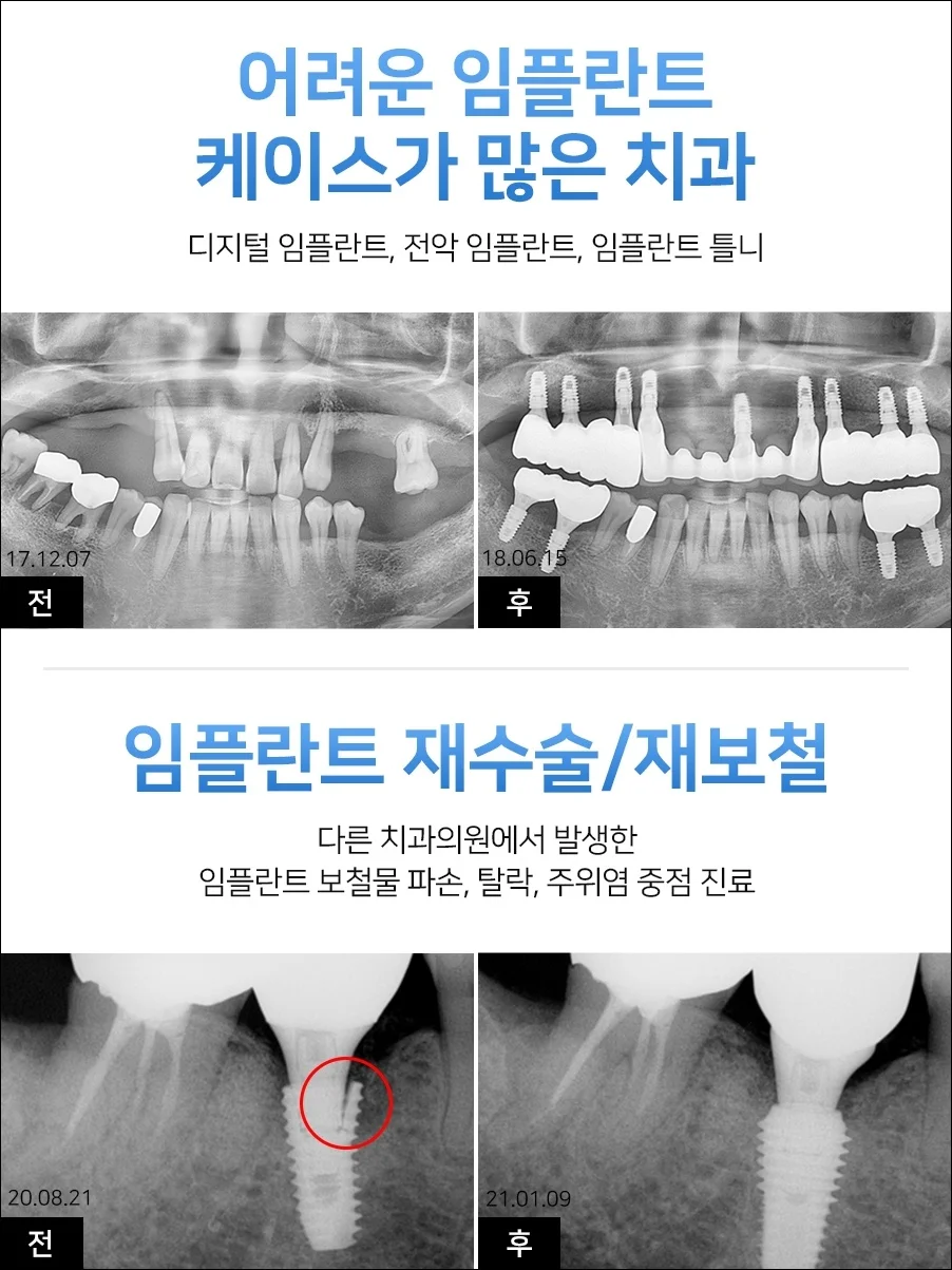 오산궐동치과추천13