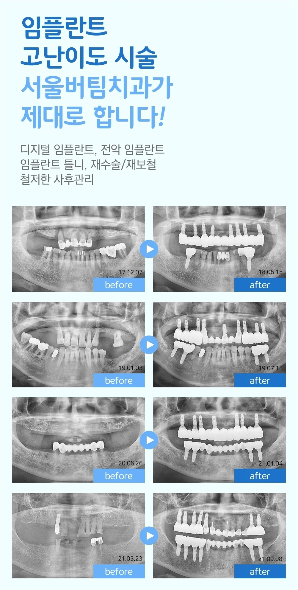 오산궐동치과추천14