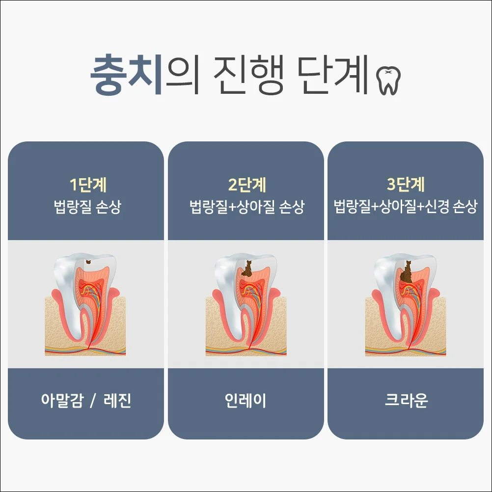 오산동잇몸치료8