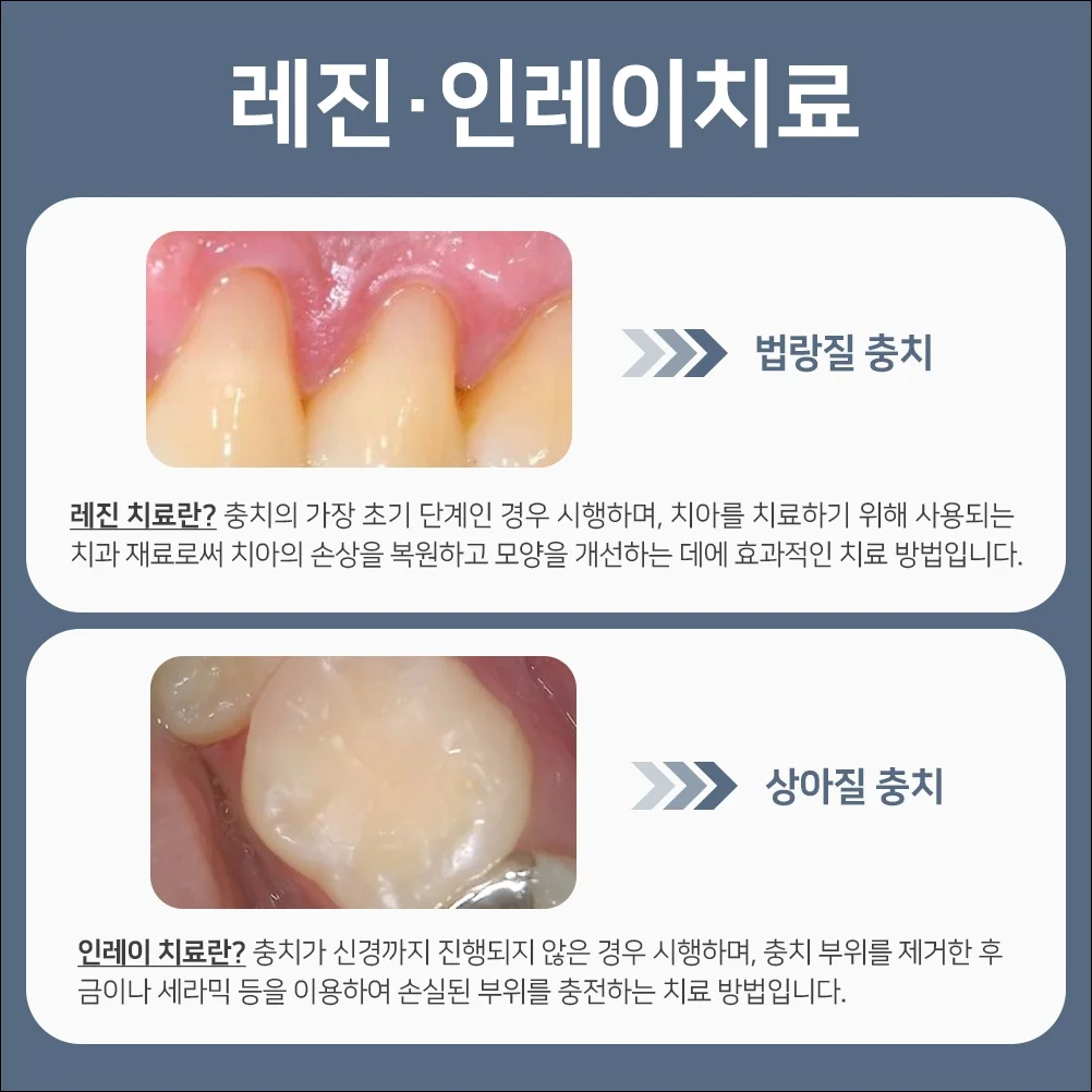 오산동잇몸치료9