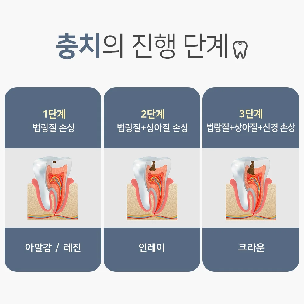 오산신경치료치과8
