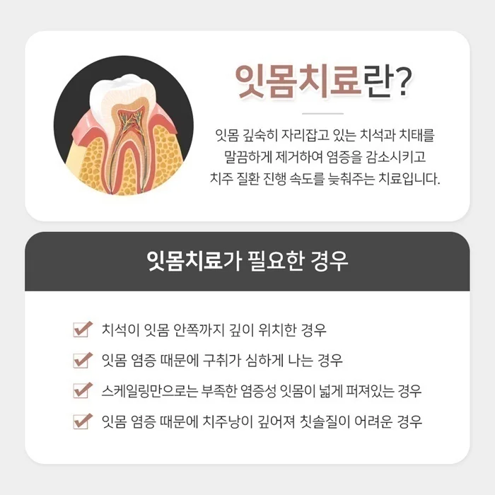 오산임플란트추천 19