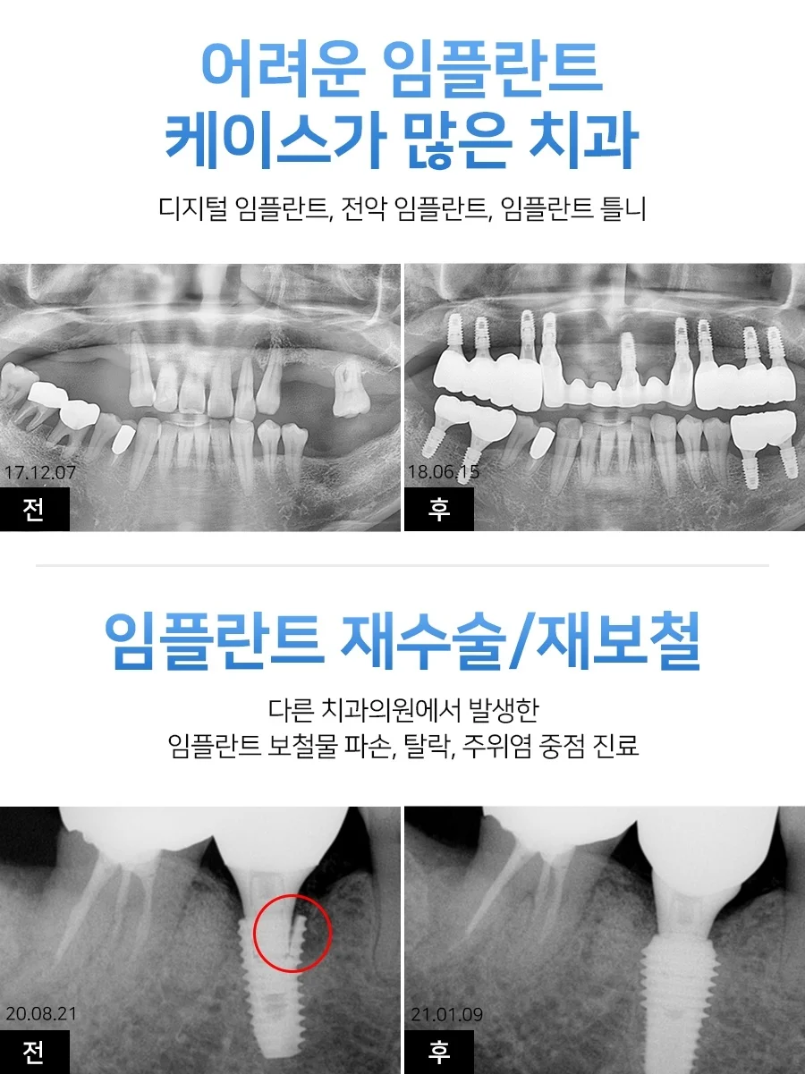 오산전악13