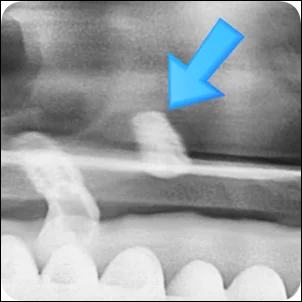 오산임플란트가격 (1)